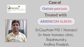 Case of Guttate Psoriasis II Homeopathy treatment II Dr Gowtham [upl. by Ainit]