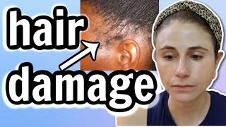 Hairstyles that DAMAGE your HAIR Traction alopecia Dr Dray [upl. by Noelani992]