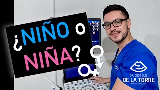 ¿Cómo saber si es NIÑO o NIÑA por ULTRASONIDO [upl. by Anerb495]