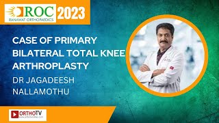 CASE OF PRIMARY BILATERAL TOTAL KNEE ARTHROPLASTY  DR JAGADEESH NALLAMOTHU  ROC 2023 [upl. by Hertz]