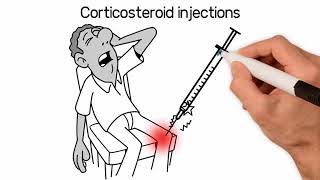 Knee Osteoarthritis Cortisone Steroid Injections NYC Dr [upl. by Claribel]