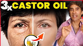 More About Castor Oil Uses and Benefits [upl. by Aillil797]