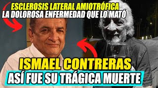 El Actor ISMAEL Contreras FALLECIÓ por una TERRIBLE y DOLOROSA ENFERMEDAD  Entretenimiento PERU [upl. by Arhez]