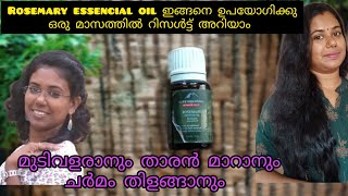 How to use rosemary essencial oil for fast hair growth alps goodness rosemary oil review malayalam [upl. by Cherian]