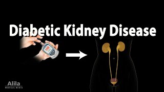 Diabetic Kidney Disease Animation [upl. by Malda786]