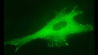 Actin Filament Induced Movement II Cell Adhesion [upl. by Sinnod]