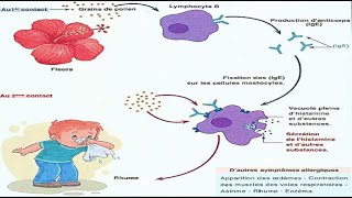 3AC  Les dysfonctionnements du système immunitaire  Les allergies  SIDA [upl. by Hsakaa945]