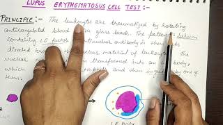 SYSTEMIC LUPUS ERYTHEMATOSUS SLE  LE CELL TEST [upl. by Pansie]