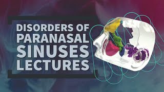 PARANASAL SINUSES lectures 13 NEOPLASMS of NASAL cavity benign tumors with important questions [upl. by Deer670]