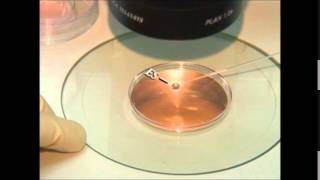 vitrification of embryos and oocytes [upl. by Winwaloe]