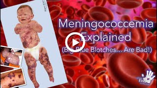 Meningococcemia Explained [upl. by Monk351]