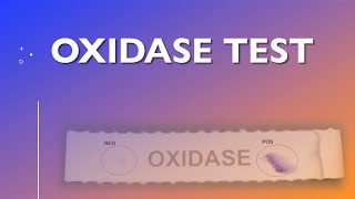 Oxidase Test [upl. by Philip]