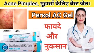 Persol ac gel 25  Benzoyl Peroxide gel 25  Benzoyl Peroxide For Acne  by Drx Pranjali Satpute [upl. by Llewxam6]