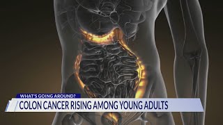 Whats Going Around  Colorectal cancer What is it and why is it rising [upl. by Nwahc]