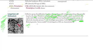 45 Langerhans cell histiocytosis [upl. by Montana]