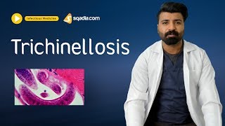 Trichinellosis  Infectious Disease Video Lectures  Medical Education  VLearning [upl. by Malva]