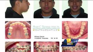 Braces in half the time See how one doctor makes it happen [upl. by Anais]