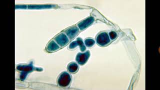 Epidermophyton macroconidia Neet image based series [upl. by Rhonda]