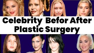 60 JAWDROPPING Celebrity Plastic Surgery Before and After Photos 2024 [upl. by Nosral865]