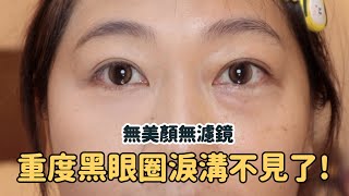 重度淚溝黑眼圈怎麼遮？看這部就對了！上妝順序詳細解說手把手教學分享❤️ [upl. by Ecinnej157]