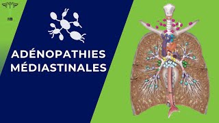 Adénopathies Médiastinales Rappel Anatomique  Diagnostique Positif  Etiologies  Traitement [upl. by Eceinart]