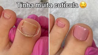 Transformação nas unhas dos pés  Cutícula e esmaltação [upl. by Nnahgiel]