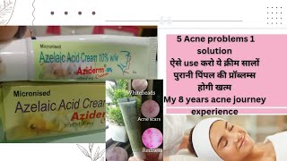 Aziderm 10 cream review how to use aziderm 10 cream aziderm review skincare youtube [upl. by Niknar]