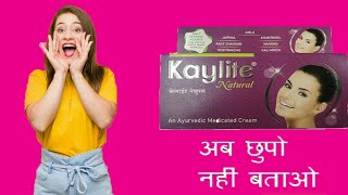 Kaylite Ayurveda Natural Face Cream  kaylite cream review  kaylite cream uses in hindi [upl. by Folberth]