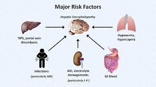 Hepatic Encephalopathy [upl. by Sayres]