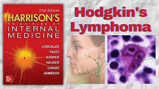 HODGKINS LYMPHOMA  Presentation  Diagnosis  Staging  Treatment  Harrison [upl. by Heydon]