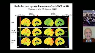 Stephen Cunnane  Cognitive improvement with ketones in mild cognitive impairment [upl. by Sadler]