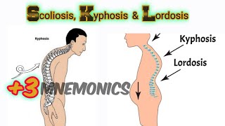 Lordosis Kyphosis and Scoliosis [upl. by Evy]