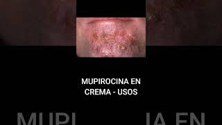 MUPIROCINA EN CREMA  USOS [upl. by Reniar]