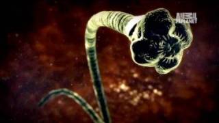 Monsters Inside Me Tapeworm Invades Brain [upl. by Zetana]