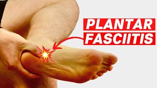 Signs of Plantar Fasciitis  3 Top Signs That You HAVE Plantar Fasciitis [upl. by Aenel]