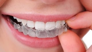 Ortodoncia invisible Inicia INVISALIGN [upl. by Dillon]