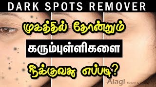 How to remove DARK SPOTS in Tamil  Clear BLACK SPOTS in One Day  Face Beauty Tips in Tamil [upl. by Kendy424]