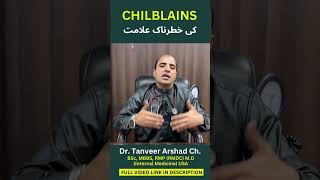 What are the danger signs of chilblains  چلبلینز کے خطرے کی علامات؟  Dr Tanveer Arshad Ch [upl. by Sellers327]