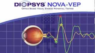 Diopsys NOVAVEP Vision Test  Eye Care [upl. by Yeslaehc]