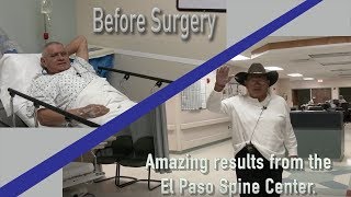 Spine Surgery Amazing Results Lumbar Kyphoplasty [upl. by Annauqal128]