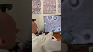 what is in your blood medicine microscope doctor channel shorts [upl. by Scharf]