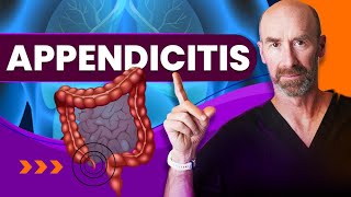 Appendicitis When SHOULD I Go To The Doctor [upl. by Stan]