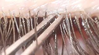 Eyelash Mites Demodex [upl. by Justicz]