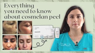 COSMELAN PEEL  SENIOR PRACTITIONERS GUIDE TO Hyperpigmentation treatment [upl. by Damalus]