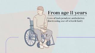 The Natural History of DMD Duchenne Muscular Dystrophy [upl. by Uni]