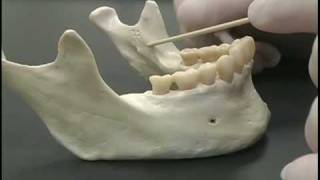 Indirect IA nerve block on a model [upl. by Norramic]