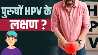 Symptoms of HPV पुरुषों में भी होता है एचपीवी जानें इस लक्षण [upl. by Airitak]