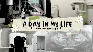 ✨A day in my life ✨ Rontgen Gigi di RSGM🦷🦷 [upl. by Celik]