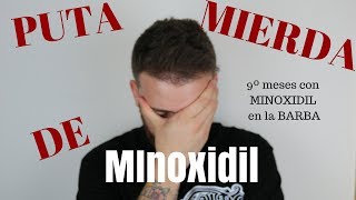 9º Meses con MINOXIDIL PUTA MIERDA DE MINOXIDIL [upl. by Ajin103]