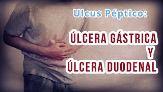 ÚLCERA GÁSTRICA Y DUODENAL Definición causas Diagnóstico diferencial y Tratamiento [upl. by Koblick]